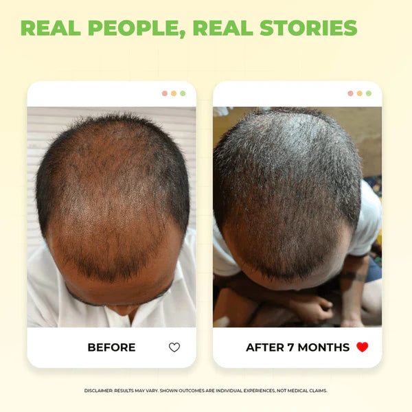 Faizora Ronaq-e-Zulf Hair Oil – Nourish, Grow & Shine (For All Hair Types)